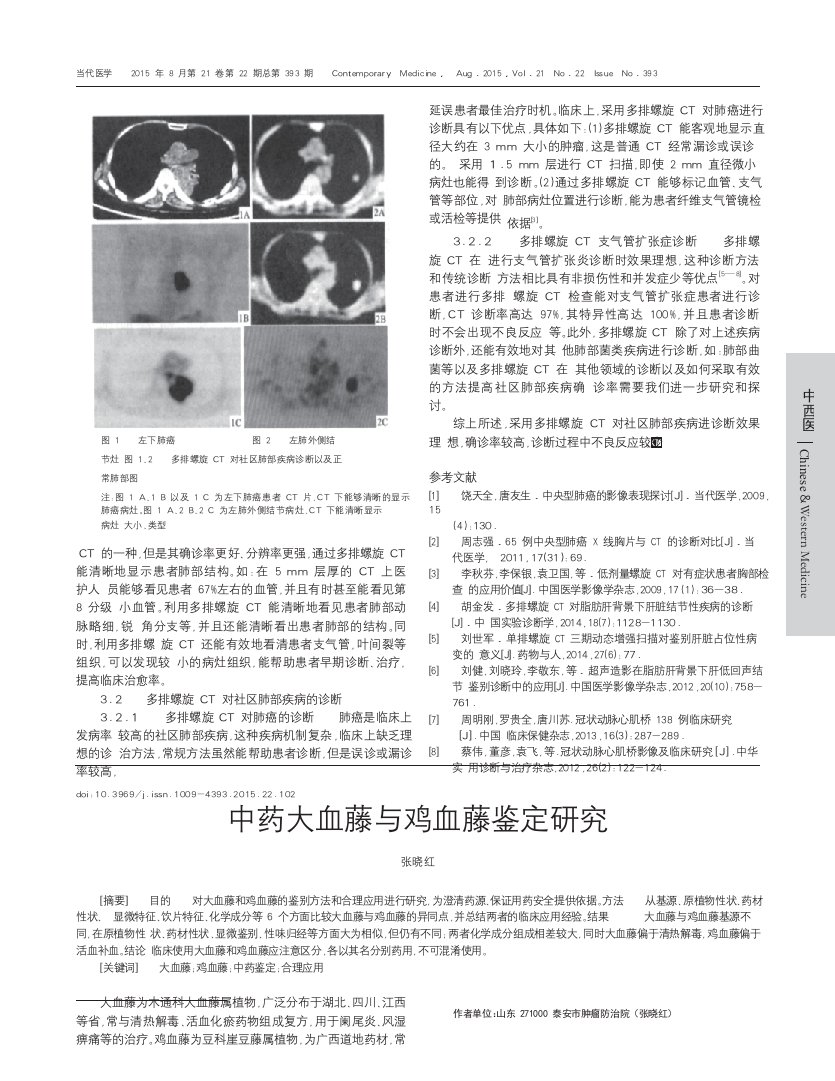 中药大血藤与鸡血藤鉴定研究