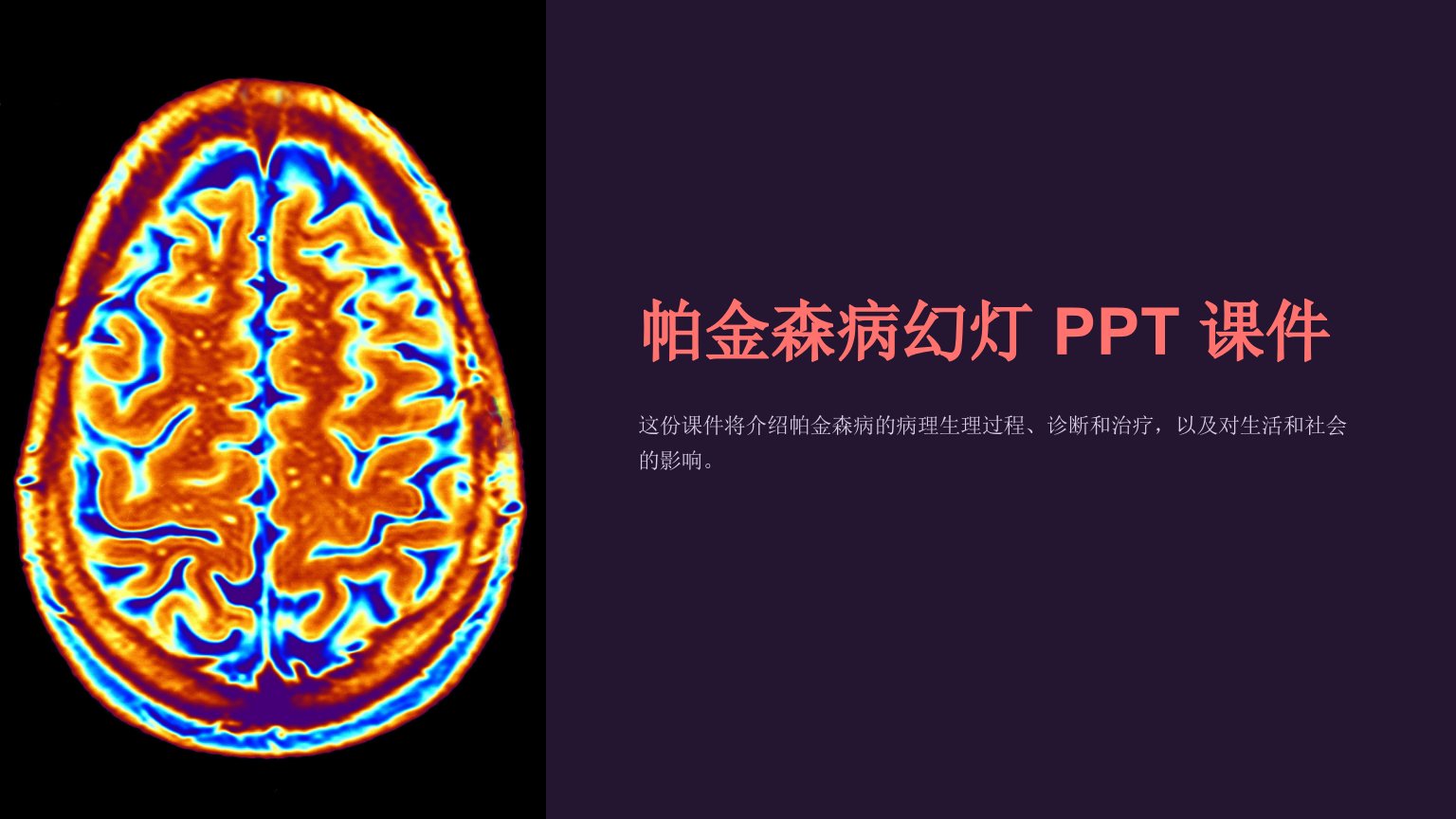 《帕金森病幻灯》课件