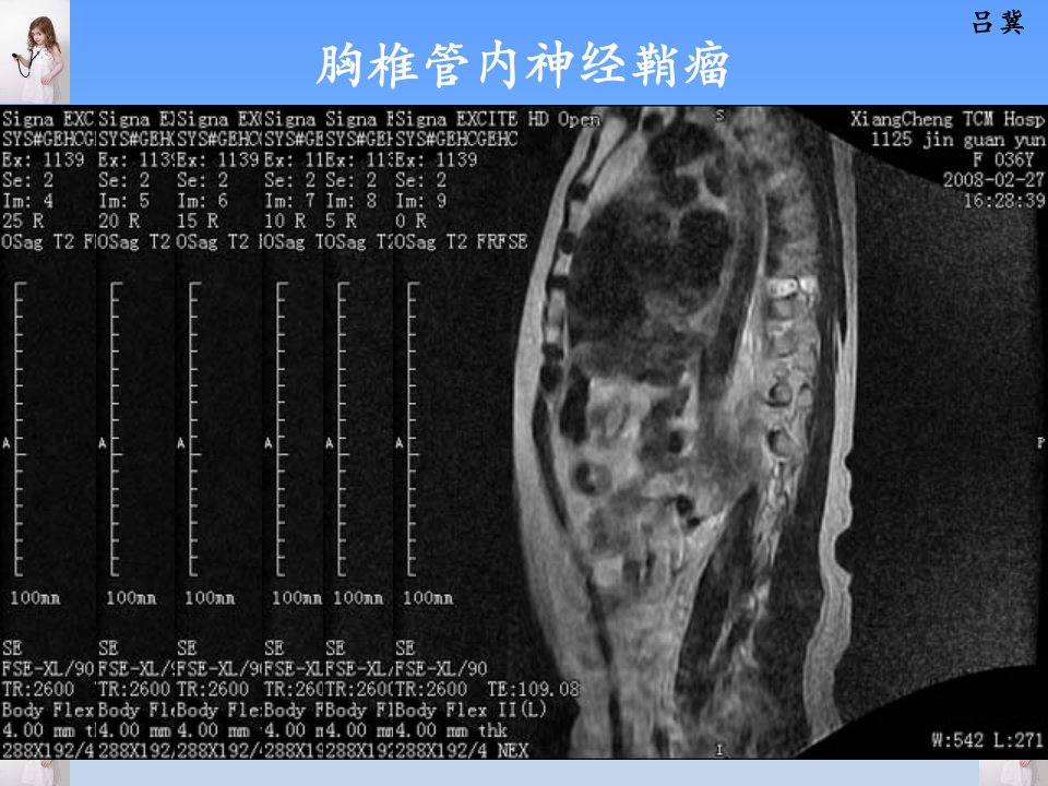 医影在线CNS疾病MRI诊断4教学提纲