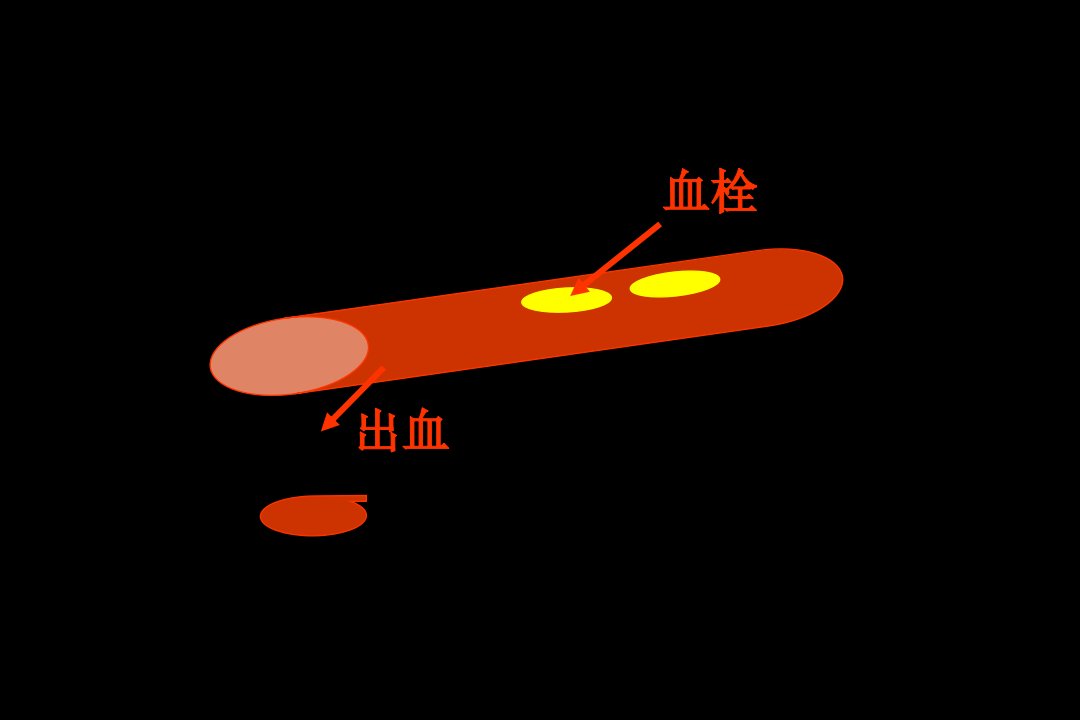 止血与血栓检测