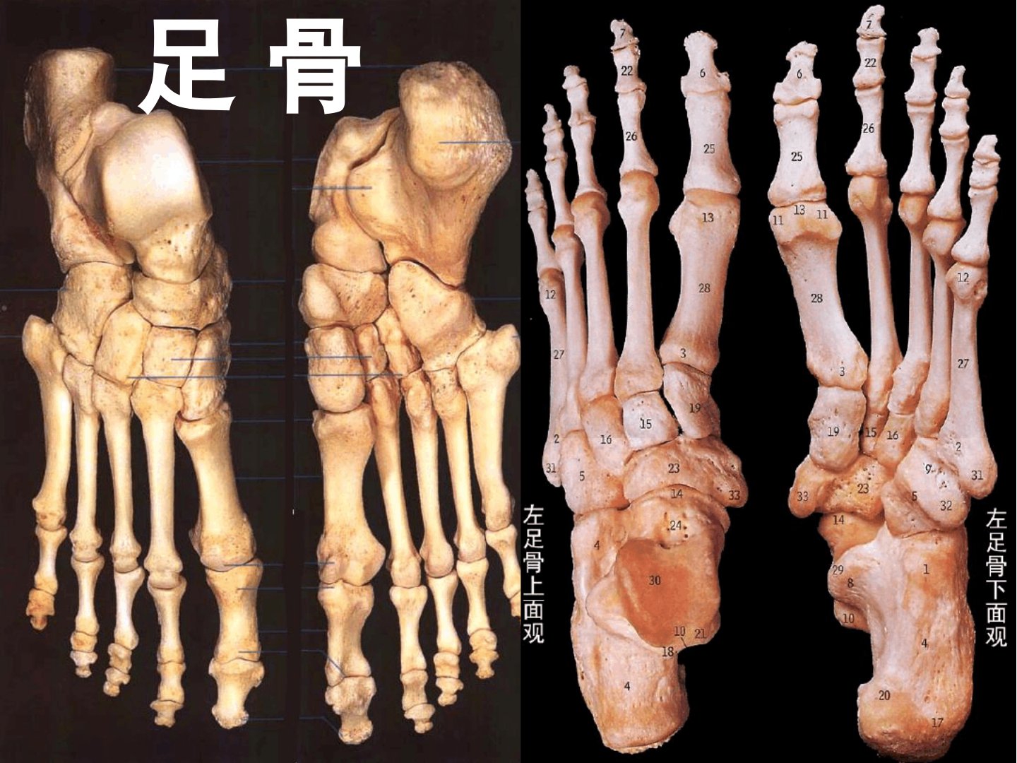 足部骨骼解剖