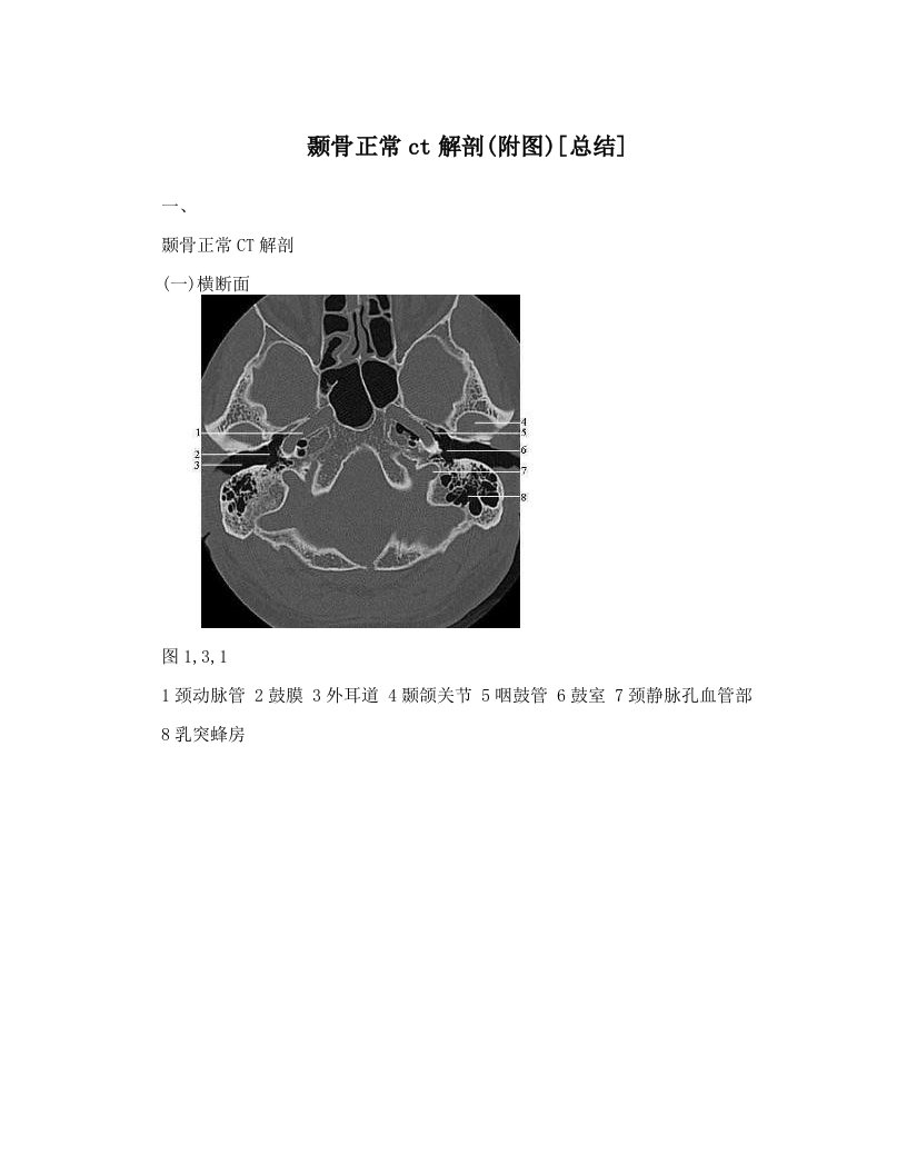 颞骨正常ct解剖&#40;附图&#41;[总结]