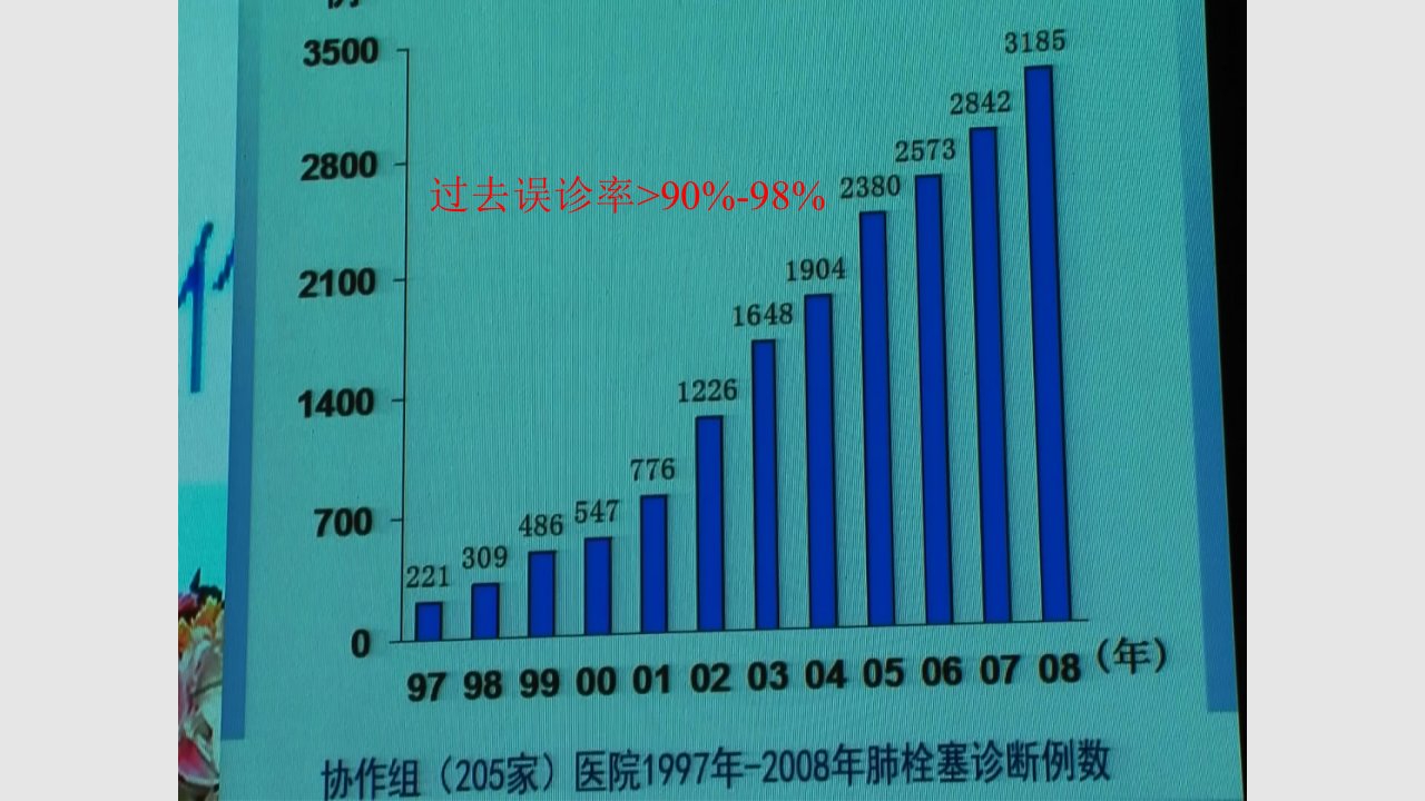 急性肺栓塞与急性冠脉综合征的鉴别