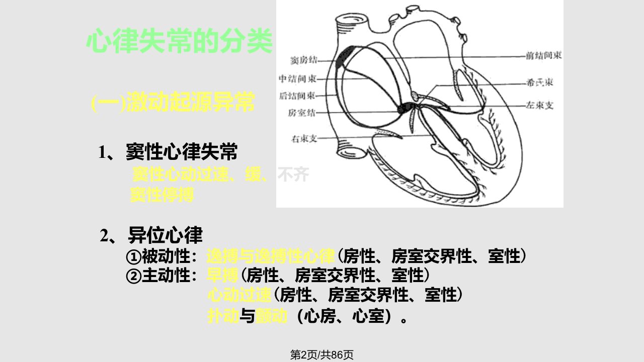 心电图心律失常