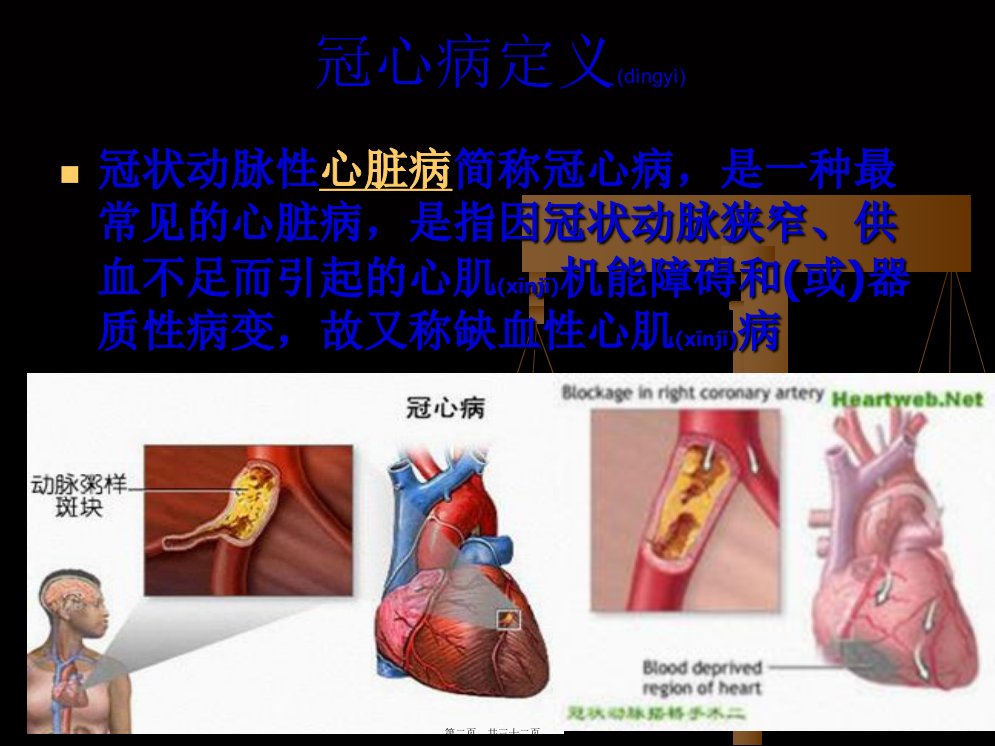 医学专题冠心病CHD