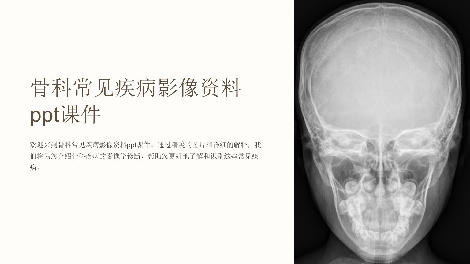 骨科常见疾病影像资料课件