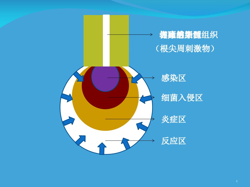 医学ppt课件根管长度测量仪