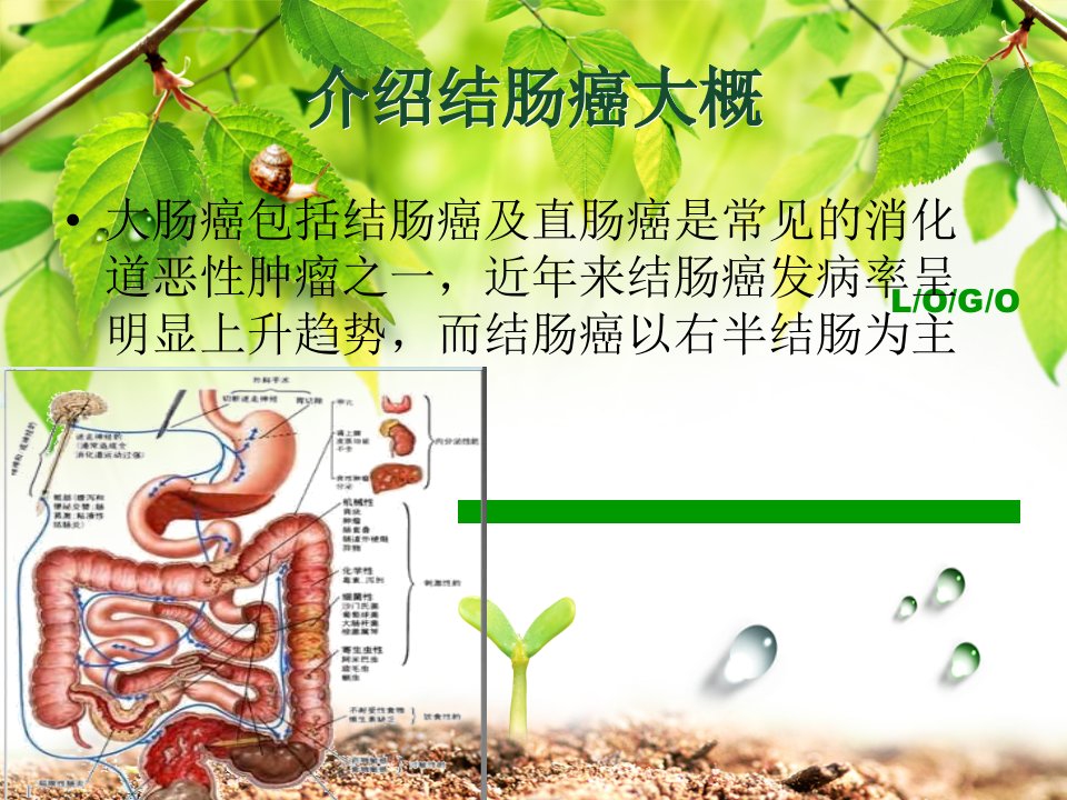 结肠癌教学查房课件