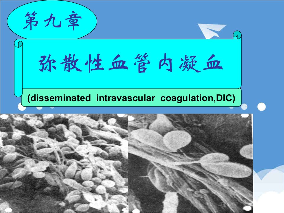 发展战略-第三节影响DIC发生发展的因素