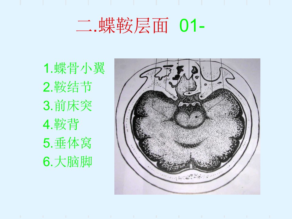 小儿头颅ct图谱2ppt培训课件