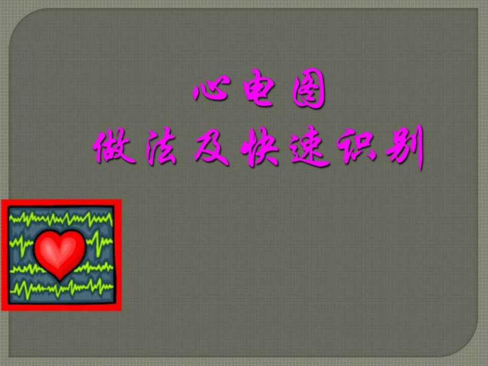 心电图操作及识别.ppt