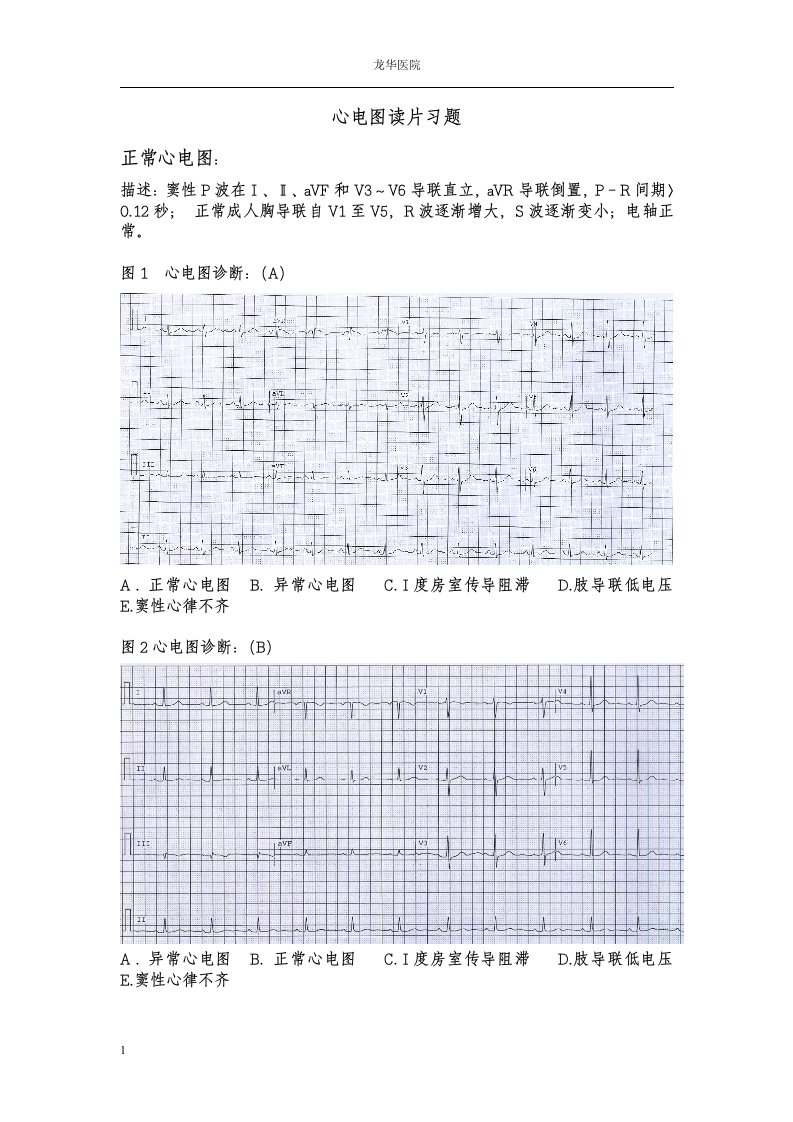 心电图读片习题