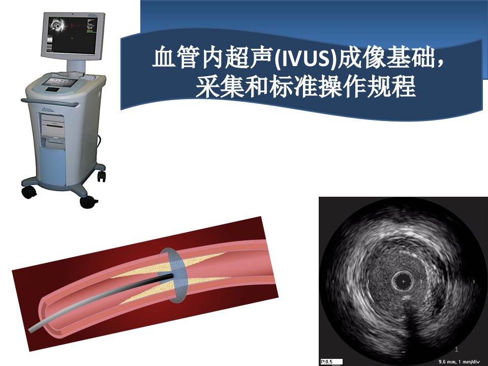 血管内超声IVUS简介ppt课件