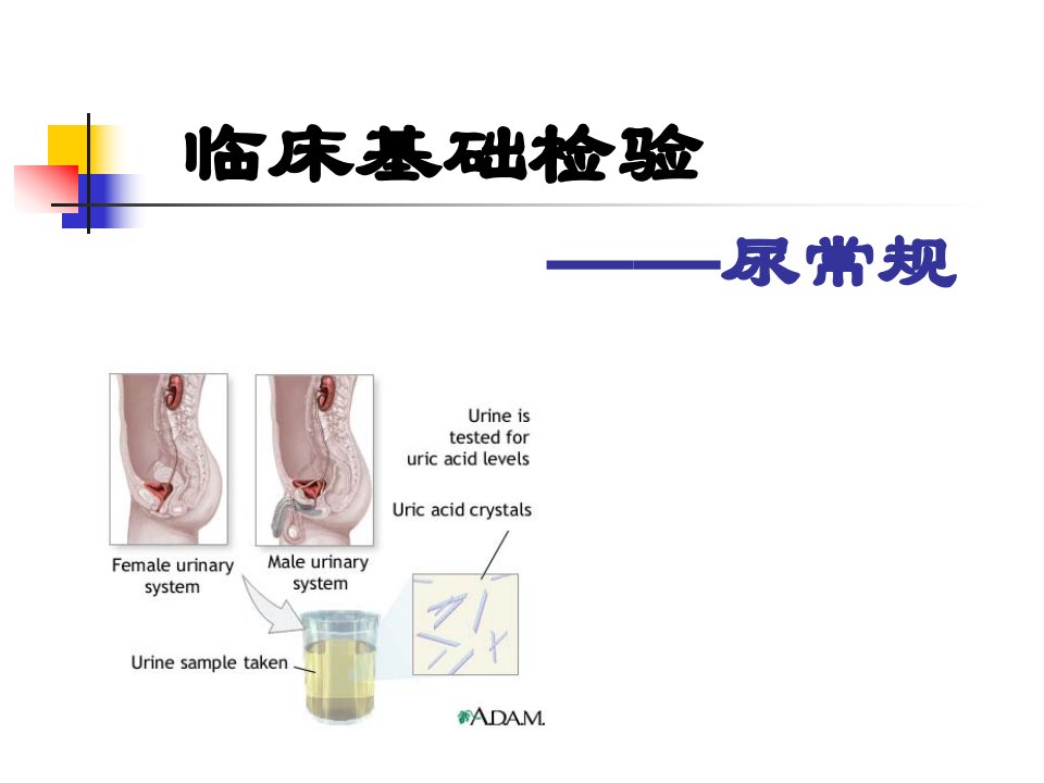 尿常规--幻灯片课件