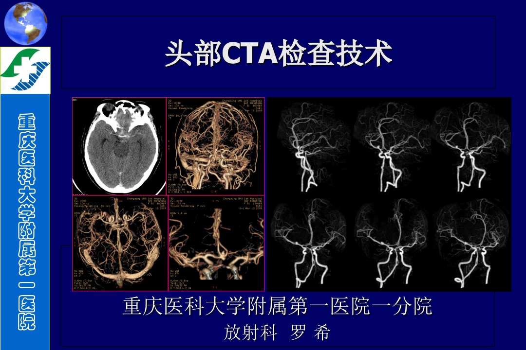 头部CTA检查技术