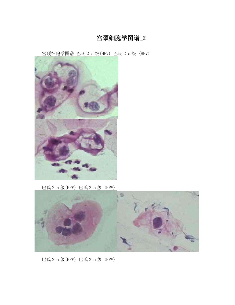 宫颈细胞学图谱_2