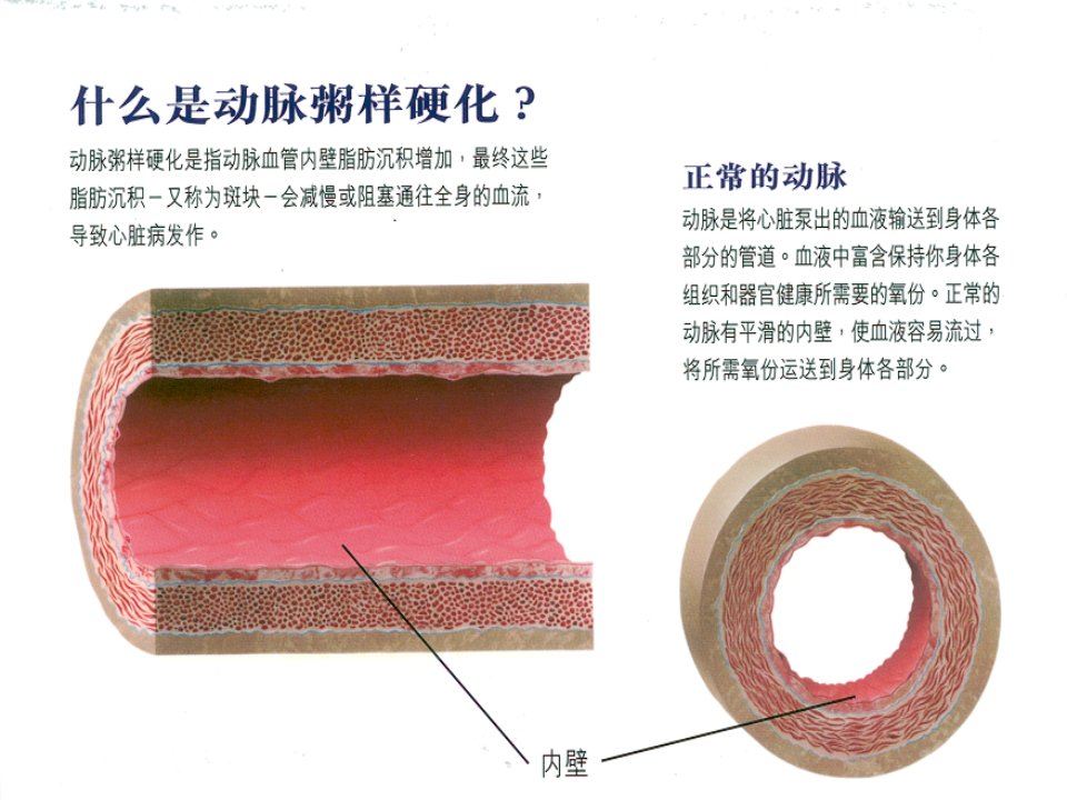 最新如何积极预防心脑血管疾病ppt课件