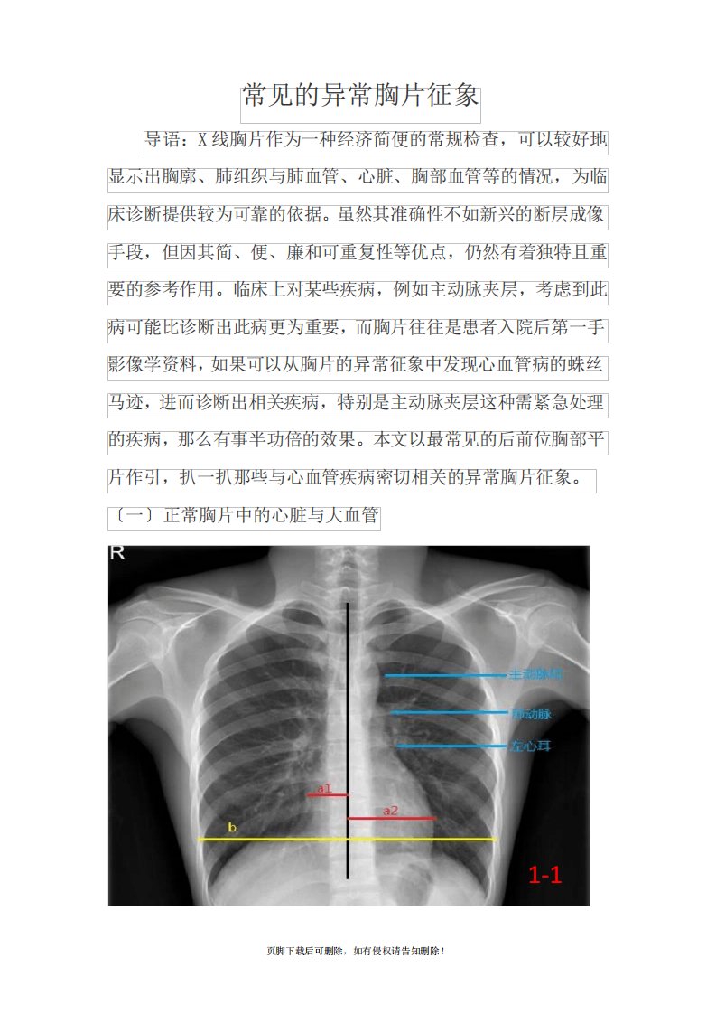 常见的X线胸片