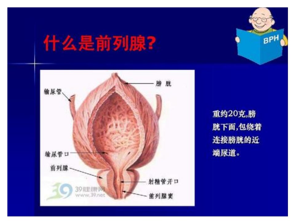 前列腺增生的术后护理ppt课件