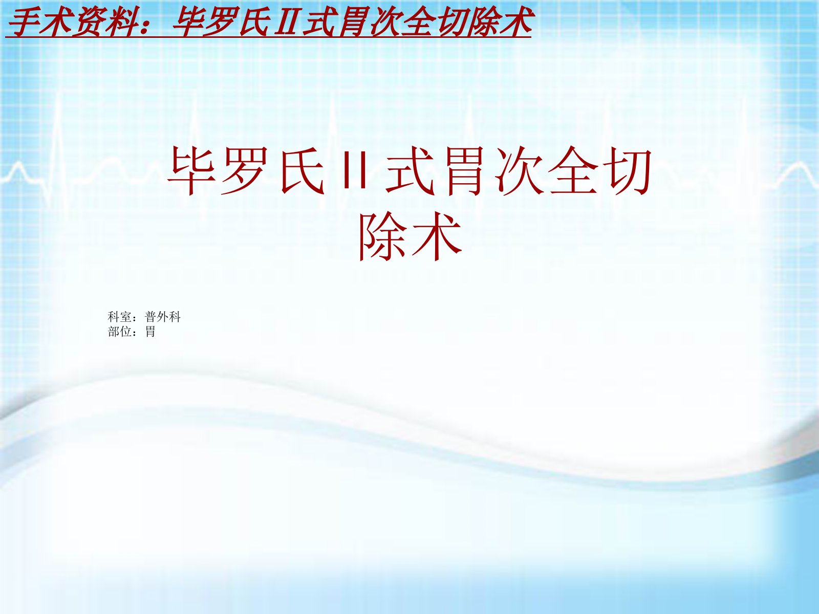 手术讲解模板毕罗氏式胃次全切除术ppt课件