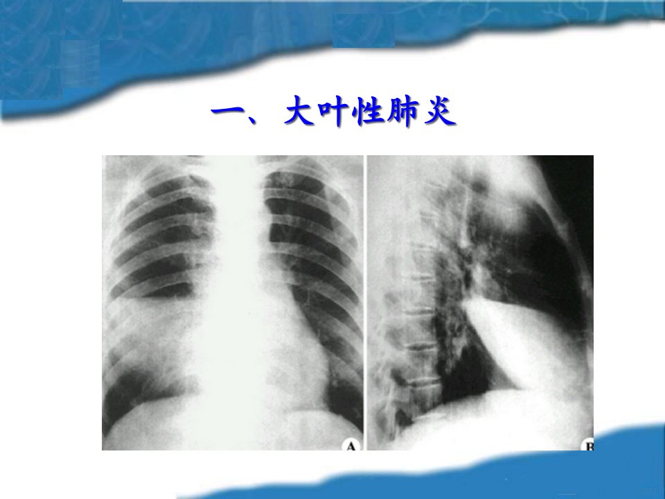 呼吸系统常见症状体征1诊断学教研室新