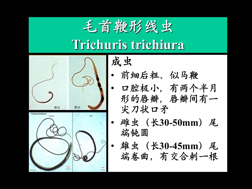 毛首鞭形线虫2Trichuristrichiura