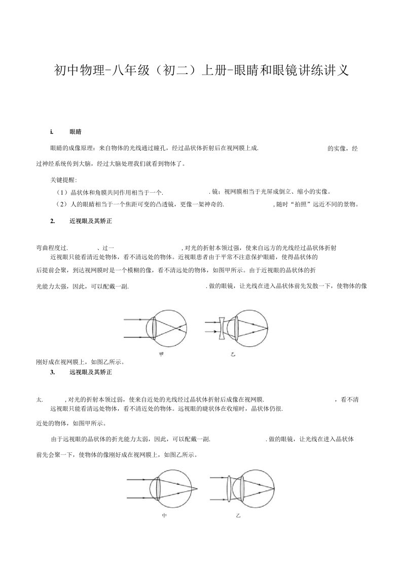 初中物理-八年级（初二）上册-专题复习讲义-眼睛和眼镜