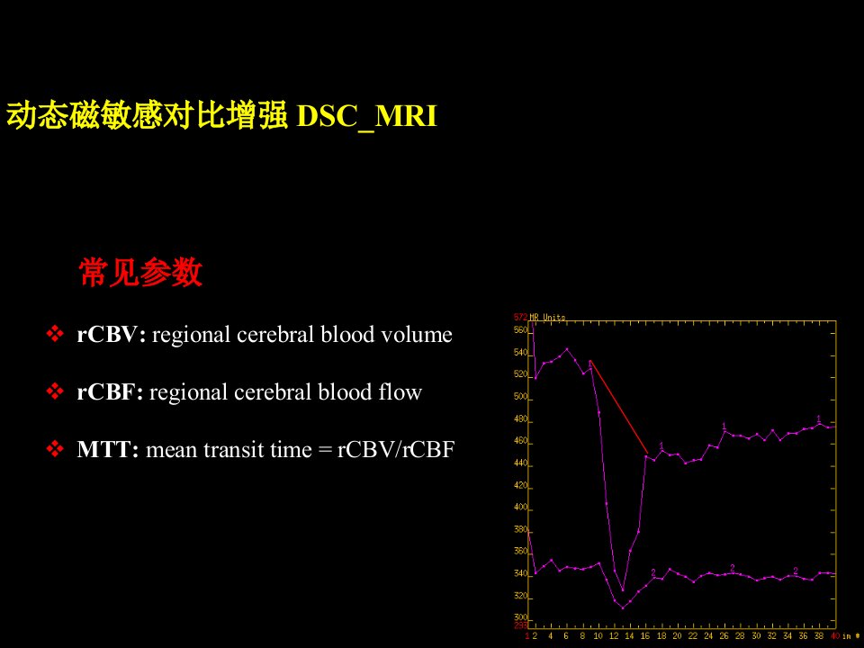 磁共振脑灌注成像介绍