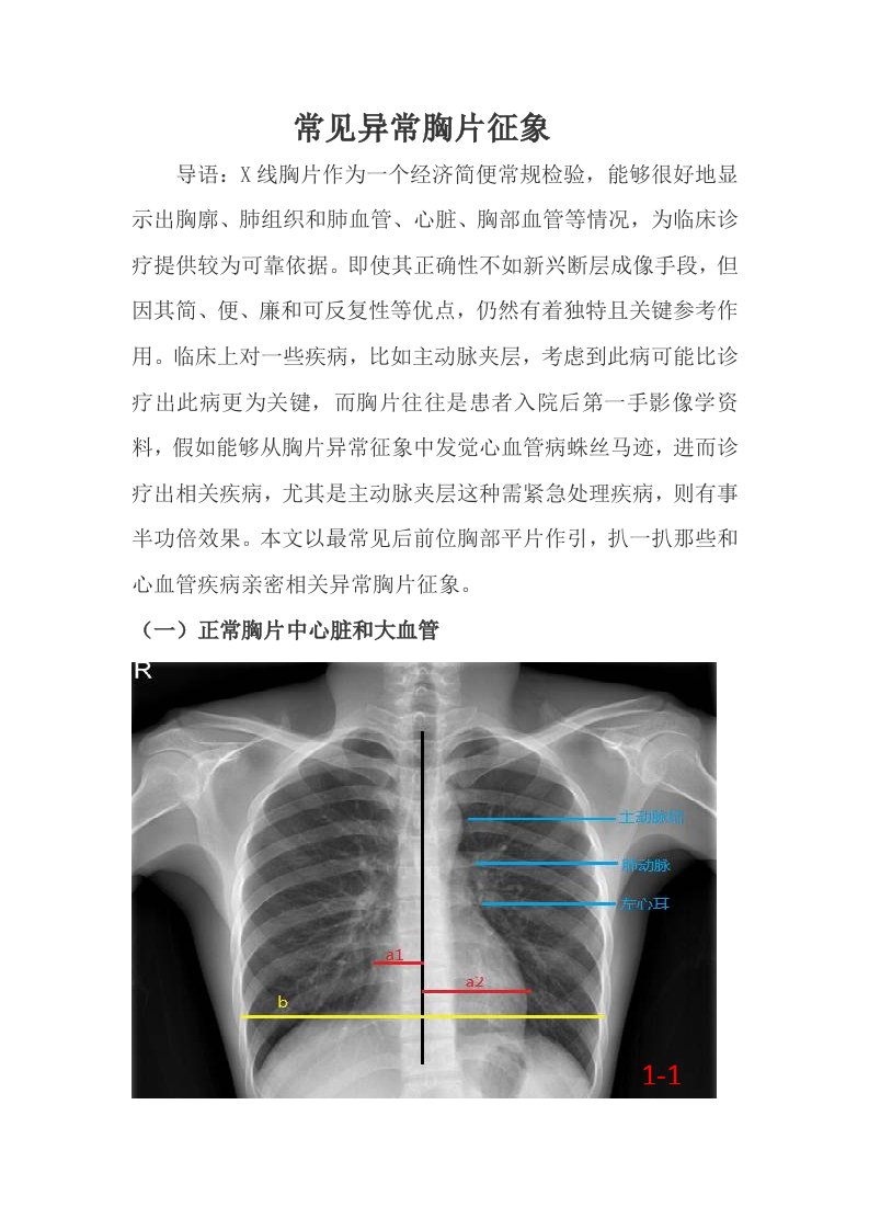 常见的X线胸片样稿