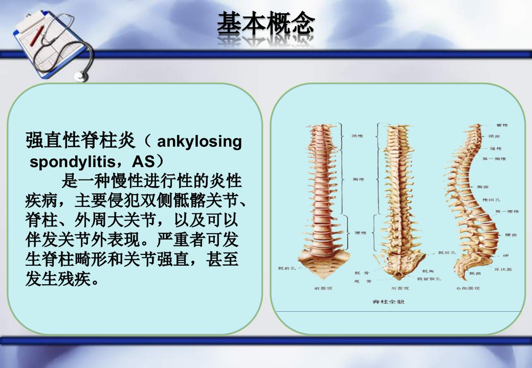 强直性脊柱炎护理