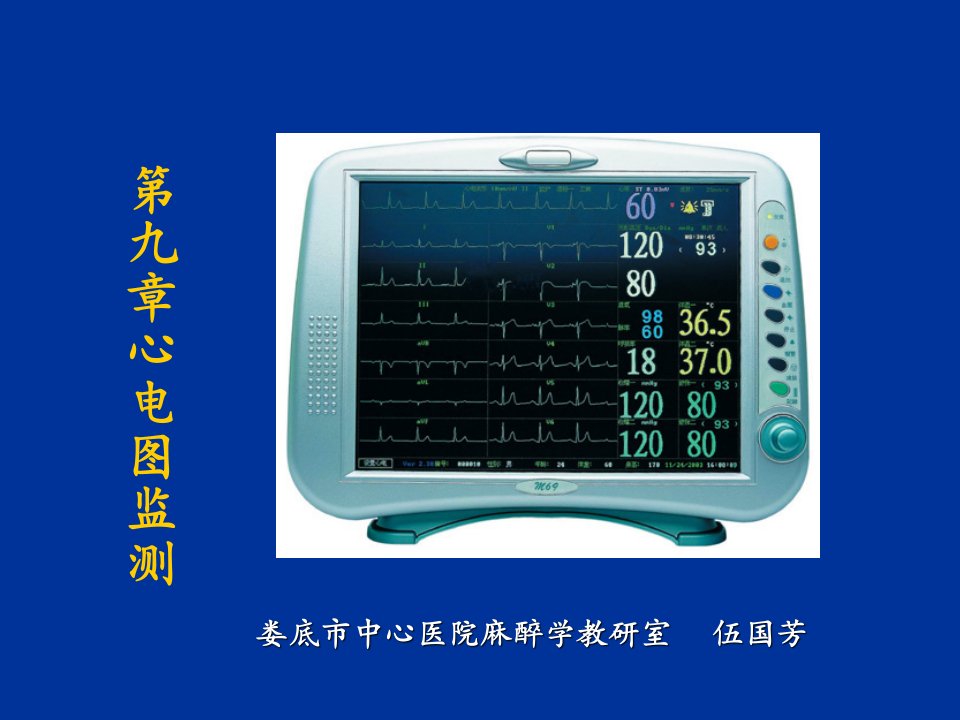 心电图监测