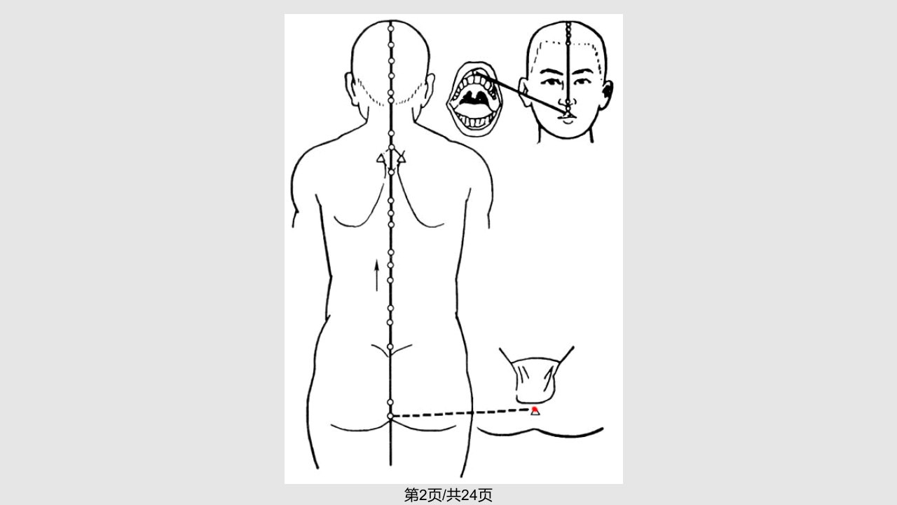 督脉与腧穴带循行动图