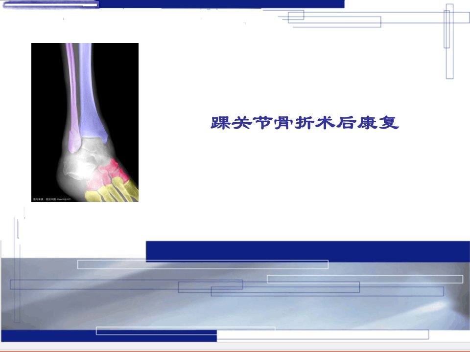 踝关节骨折术后康复