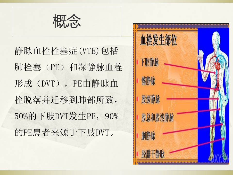 VTE的预防与治疗