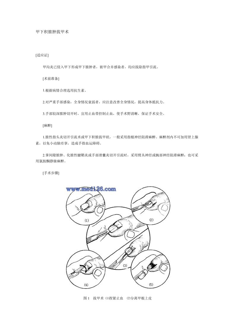 拔甲基本操作流程