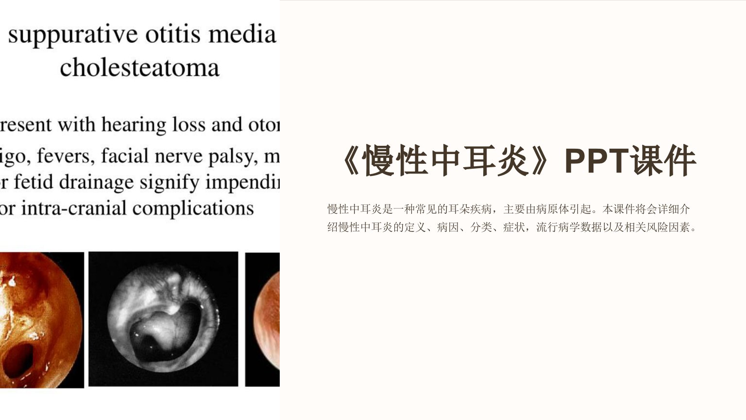 《慢性中耳炎》课件