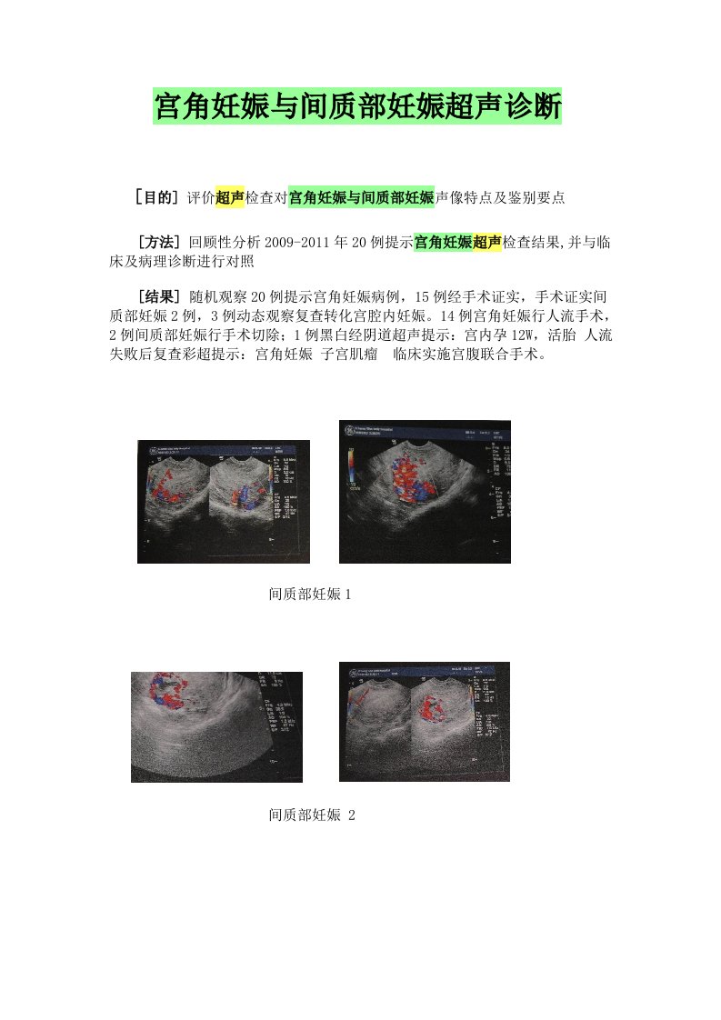 宫角妊娠间质部妊娠超声鉴别