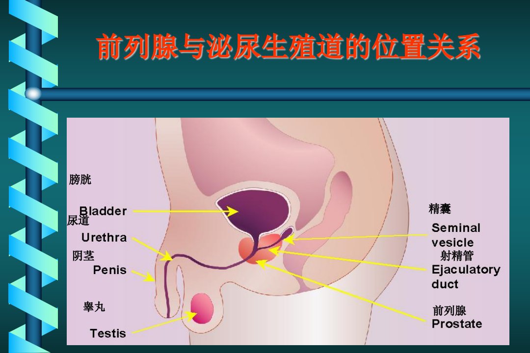 前列腺癌的诊断和治疗课件