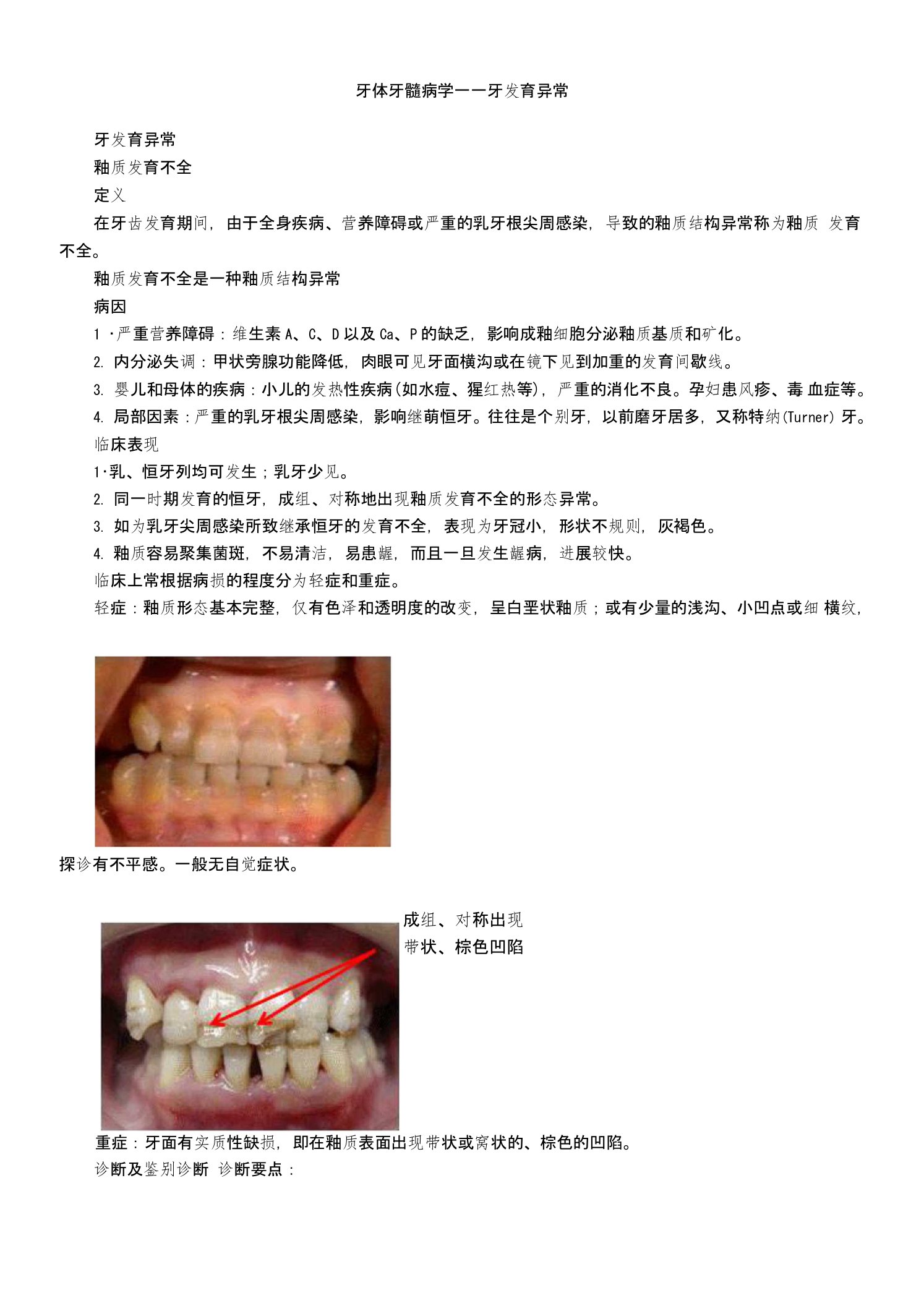 主管护师护士护理考研资格考试题库牙体牙髓病学牙发育异常