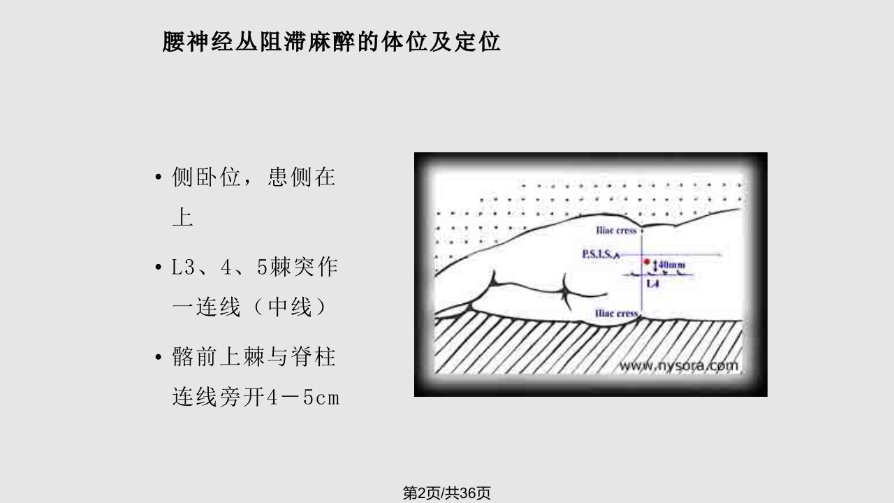 骨科手术的麻醉