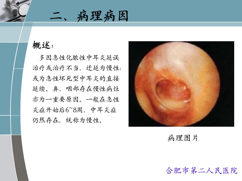 医学专题慢性化脓性中耳炎