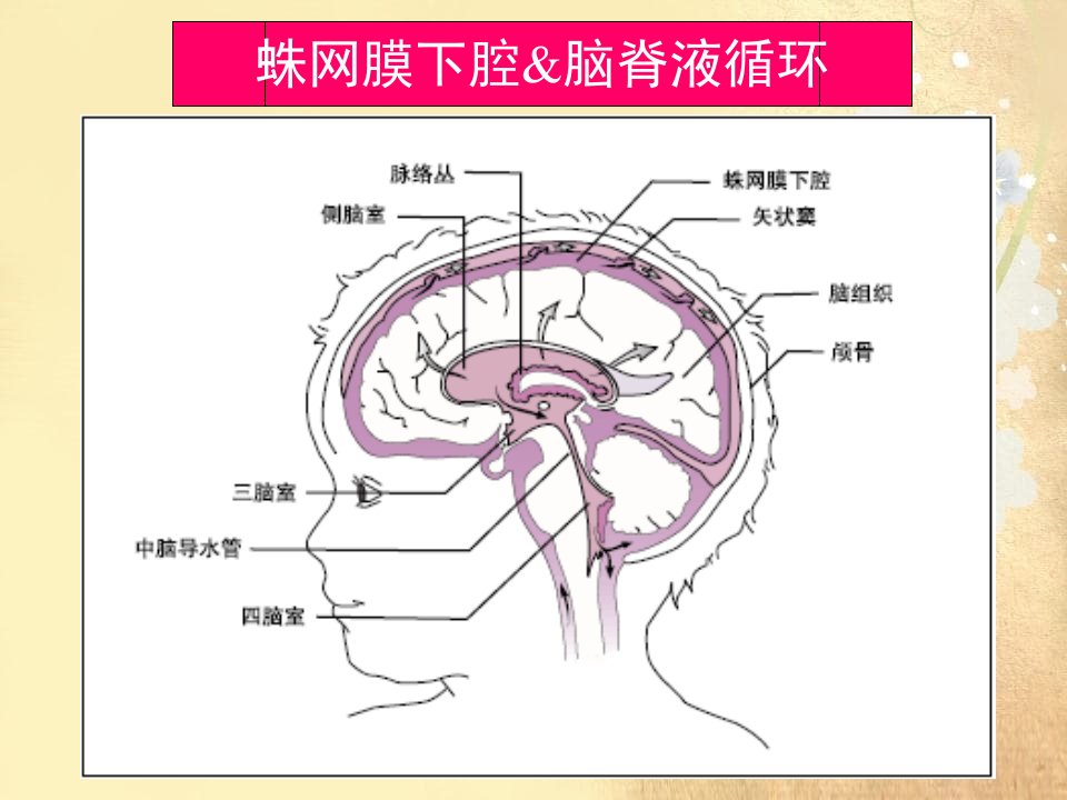 蛛网膜下腔出血课件