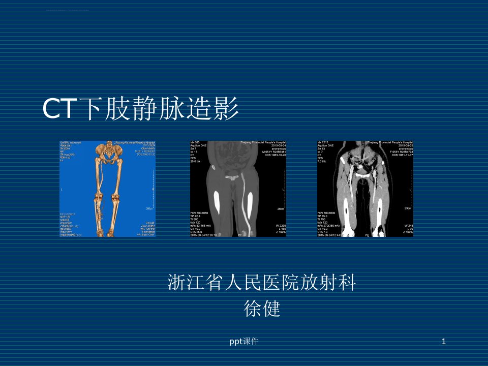 CT下肢静脉造影【放射科】--ppt课件