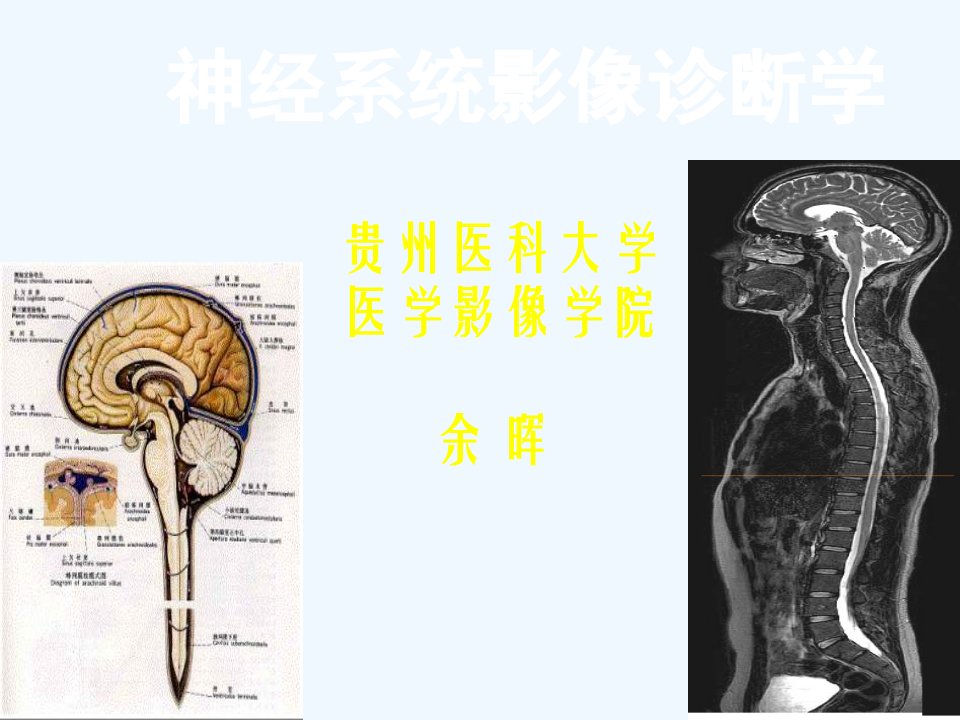 第一讲神经系统影像检查方法及临床应用