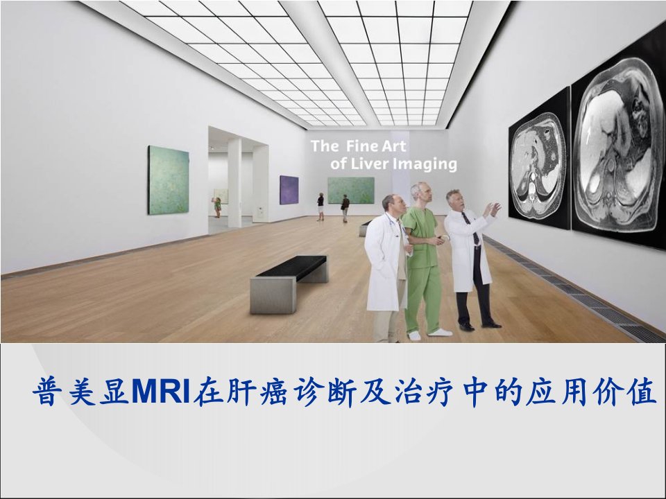 普美显MRI在肝癌诊断及治疗中的应用价值