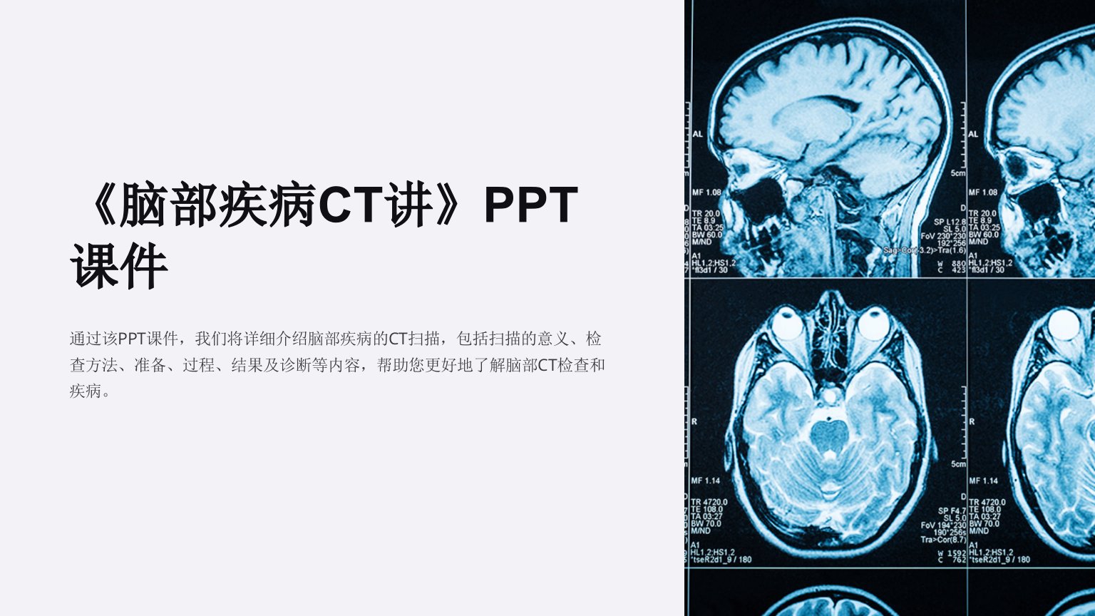 《脑部疾病CT讲》课件