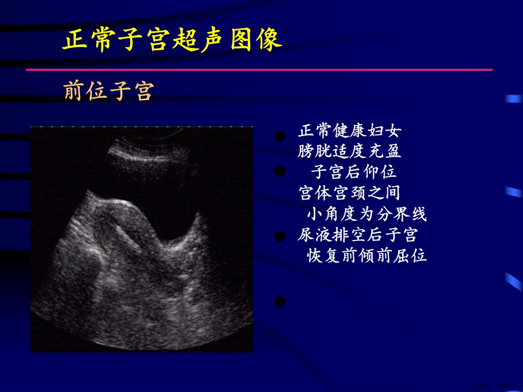 妇科疾病超声检查图谱解析课件PPT105页