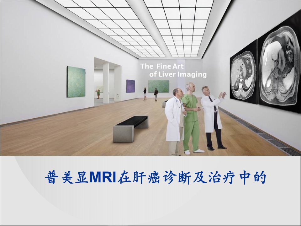 普美显MRI在肝癌诊断及治疗中的应用价值