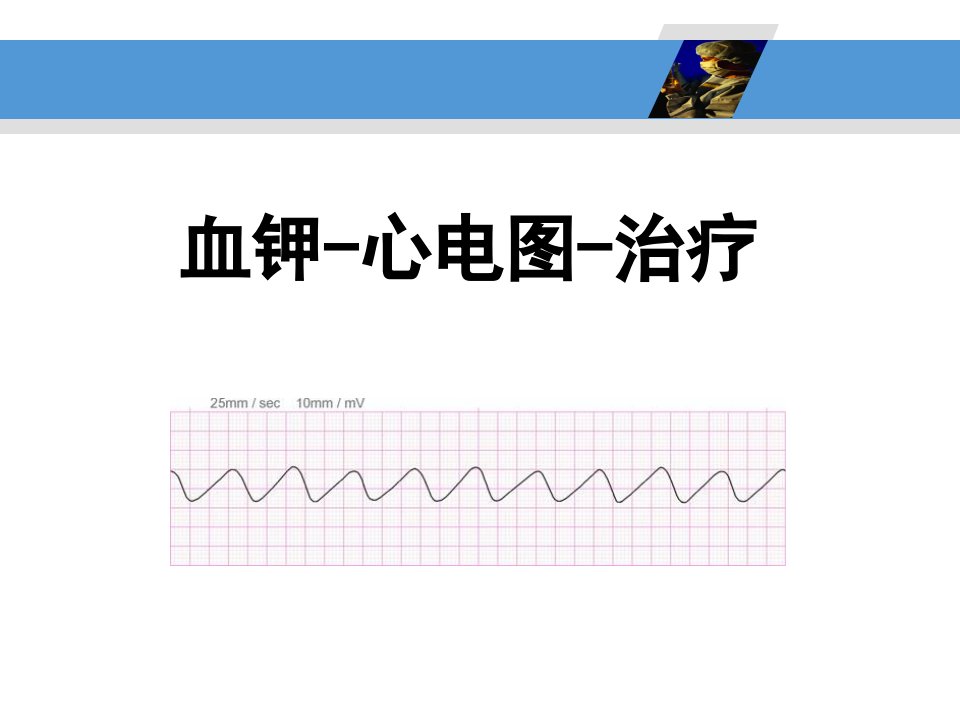 血钾-心电图-治疗