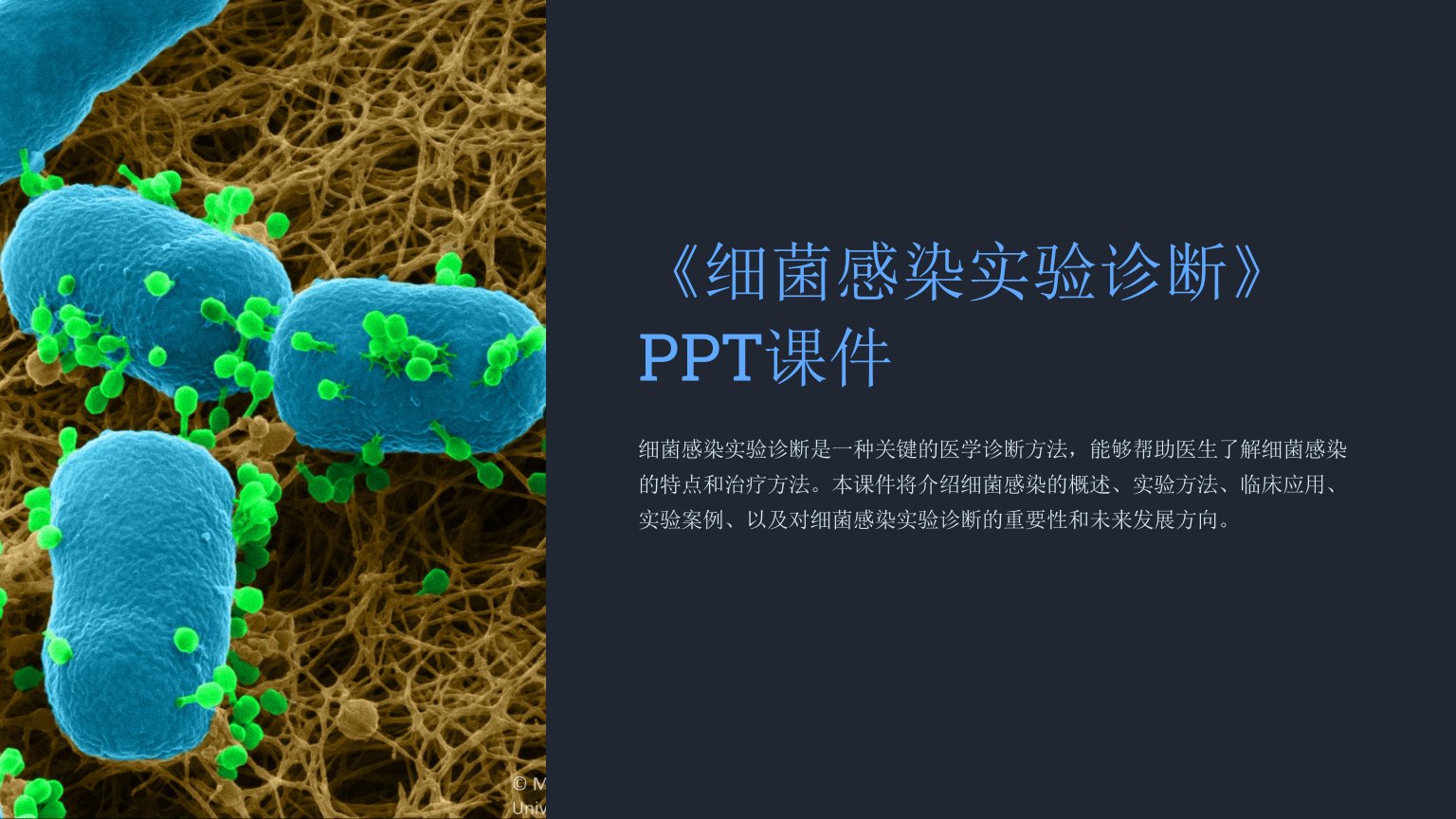 《细菌感染实验诊断》课件